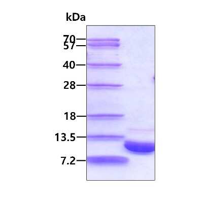 SDS-PAGE: Recombinant Mouse S100A1 His Protein [NBP1-72335]